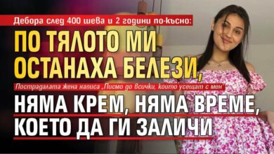 Дебора след 400 шева и 2 години по-късно: По тялото ми останаха белези, няма крем, няма време, което да ги заличи