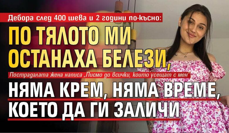 Дебора след 400 шева и 2 години по-късно: По тялото ми останаха белези, няма крем, няма време, което да ги заличи