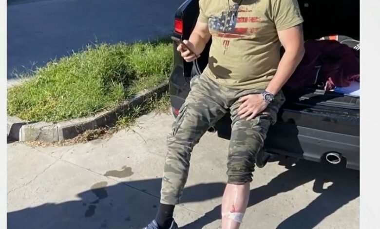 В двора на ВиК-Пловдив: Мъж падна в дълбока шахта и си счупи крака и главата